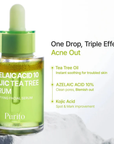Suero Antiacne, Despigmentante y Calmante, 30 Ml